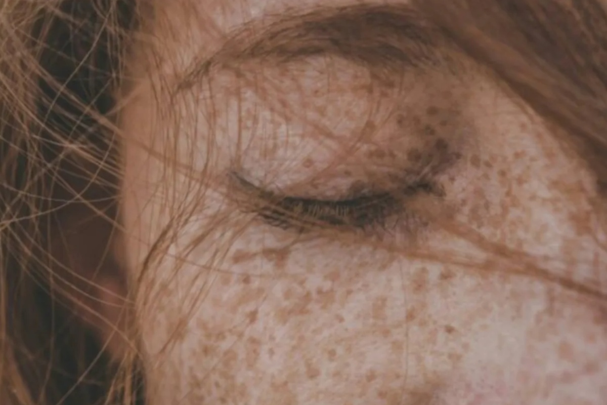 oči, koža, pjegice, Best of Beauty 2025
