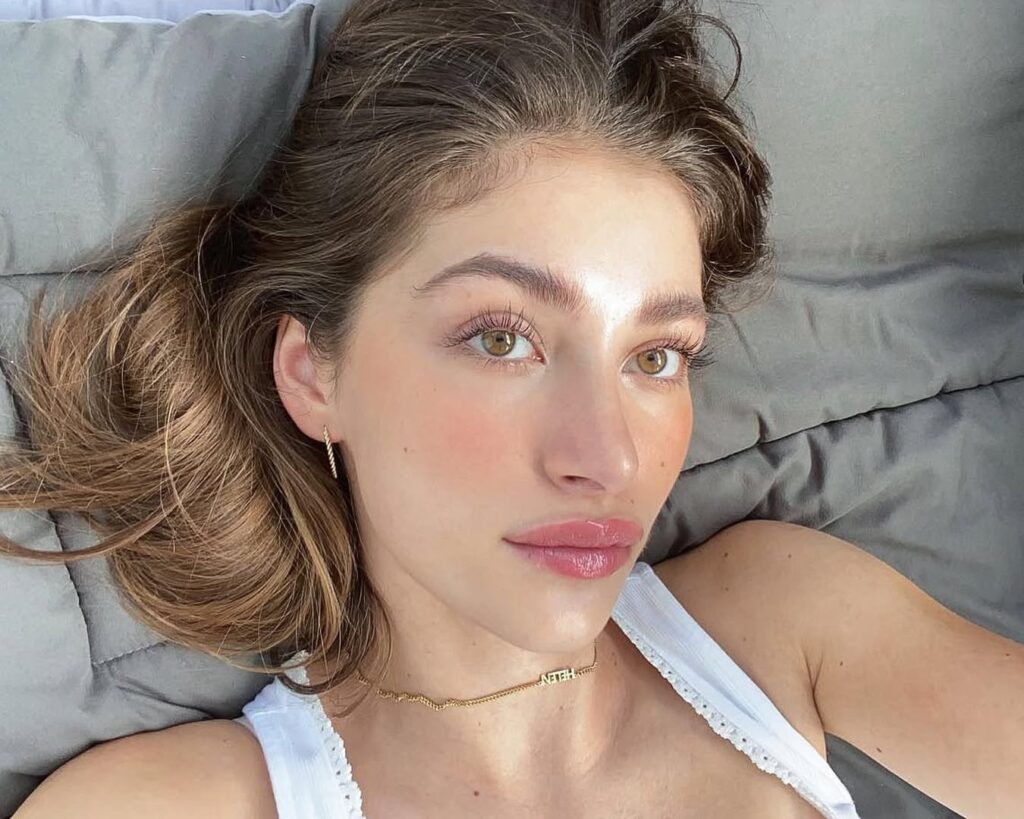 facelift